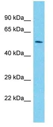 Anti-PAX7 antibody, C-term used in Western Blot (WB). GTX77888