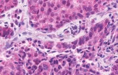 Anti-F4/80 antibody used in IHC (Paraffin sections) (IHC-P). GTX77949