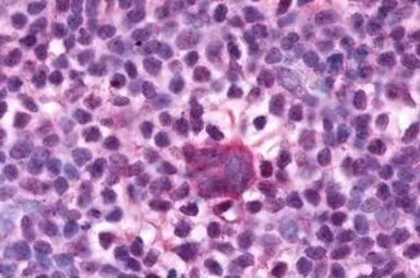 Anti-F4/80 antibody used in IHC (Paraffin sections) (IHC-P). GTX77949