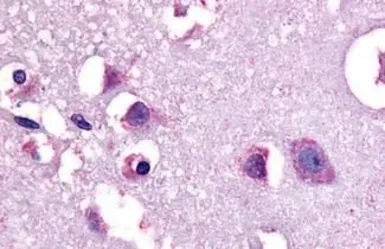 Anti-CRHR1 antibody used in IHC (Paraffin sections) (IHC-P). GTX77983