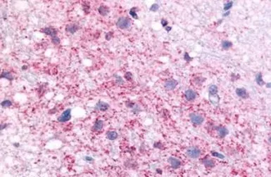 Anti-CRHR1 antibody used in IHC (Paraffin sections) (IHC-P). GTX77983