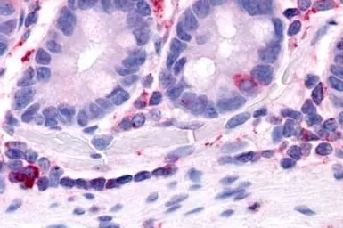 Anti-HNF4 gamma antibody used in IHC (Paraffin sections) (IHC-P). GTX78089