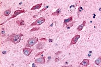 Anti-TAOK1 antibody used in IHC (Paraffin sections) (IHC-P). GTX78125