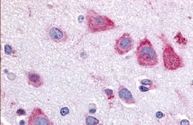 Anti-TAOK1 antibody used in IHC (Paraffin sections) (IHC-P). GTX78125