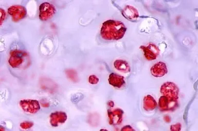Anti-ADAMTS4 antibody used in IHC (Paraffin sections) (IHC-P). GTX78143