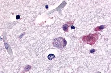 Anti-CDC7 antibody used in IHC (Paraffin sections) (IHC-P). GTX78149