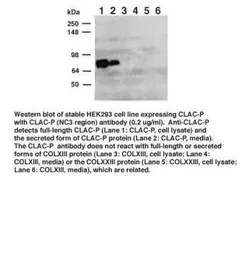 Anti-CLACP antibody used in Western Blot (WB). GTX78175