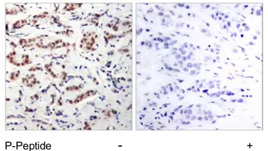 Anti-STAT5A (phospho Tyr694) antibody used in IHC (Paraffin sections) (IHC-P). GTX78938
