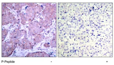 Anti-PTEN (phospho Ser380) antibody used in IHC (Paraffin sections) (IHC-P). GTX78960