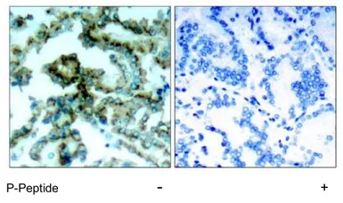 Anti-PKC beta 2 (phospho Thr641) antibody used in IHC (Paraffin sections) (IHC-P). GTX78969