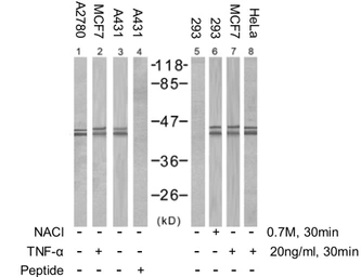 Anti-ERK1 (phospho Thr202) + ERK2 (phospho Thr185) antibody used in Western Blot (WB). GTX78988