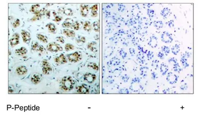 Anti-NFkB p65 (phospho Ser311) antibody used in IHC (Paraffin sections) (IHC-P). GTX78995