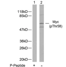Anti-c-Myc (phospho Thr58) antibody used in Western Blot (WB). GTX79007