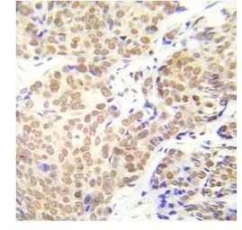 Anti-HDAC1 (phospho Ser421/Ser423) antibody used in IHC (Paraffin sections) (IHC-P). GTX79062