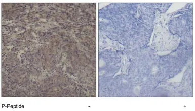Anti-CREB (phospho Ser142) antibody used in IHC (Paraffin sections) (IHC-P). GTX79098
