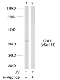 Anti-CREB (phospho Ser133) antibody used in Western Blot (WB). GTX79100