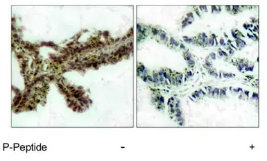 Anti-AKT (phospho Thr308) antibody used in IHC (Paraffin sections) (IHC-P). GTX79150