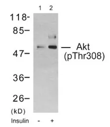 Anti-AKT (phospho Thr308) antibody used in Western Blot (WB). GTX79150