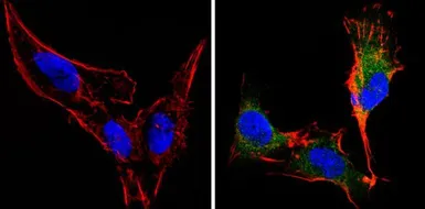 Anti-Recoverin antibody [6a55 cd6] used in Immunocytochemistry/ Immunofluorescence (ICC/IF). GTX79211