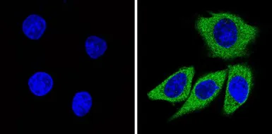Anti-Recoverin antibody [6a55 cd6] used in Immunocytochemistry/ Immunofluorescence (ICC/IF). GTX79211