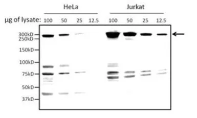 Anti-IGF2R antibody used in Western Blot (WB). GTX79239