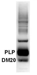 Anti-Myelin PLP antibody used in Western Blot (WB). GTX79242
