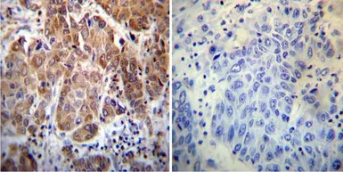 Anti-Cyclophilin 40 antibody used in IHC (Paraffin sections) (IHC-P). GTX79245