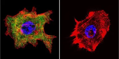 Anti-Cyclophilin 40 antibody used in Immunocytochemistry/ Immunofluorescence (ICC/IF). GTX79245