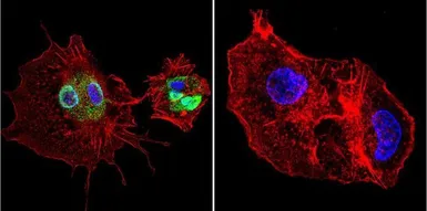 Anti-Cyclophilin 40 antibody used in Immunocytochemistry/ Immunofluorescence (ICC/IF). GTX79245