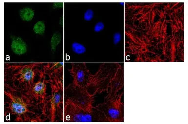 Anti-JunB antibody used in Immunocytochemistry/ Immunofluorescence (ICC/IF). GTX79258