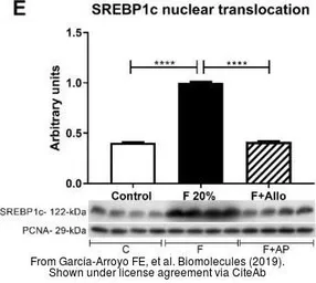Anti-SREBP1 antibody used in Western Blot (WB). GTX79299