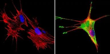 Anti-SREBP1 antibody used in Immunocytochemistry/ Immunofluorescence (ICC/IF). GTX79299