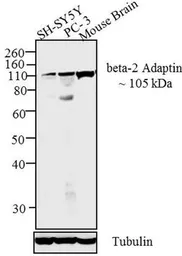 Anti-AP2B1 antibody used in Western Blot (WB). GTX79316