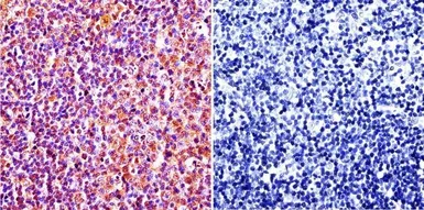 Anti-Caveolin 1 antibody [7C8] used in IHC (Paraffin sections) (IHC-P). GTX79350