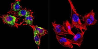 Anti-Caveolin 1 antibody [7C8] used in Immunocytochemistry/ Immunofluorescence (ICC/IF). GTX79350