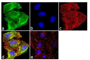 Anti-TIMP2 antibody [F27 P3 A4] used in Immunocytochemistry/ Immunofluorescence (ICC/IF). GTX79355