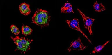 Anti-TIMP2 antibody [F27 P3 A4] used in Immunocytochemistry/ Immunofluorescence (ICC/IF). GTX79355