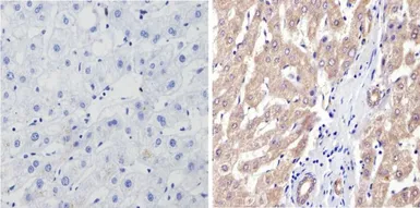 Anti-CYP3A7 antibody [F19 P2 H2] used in IHC (Paraffin sections) (IHC-P). GTX79463