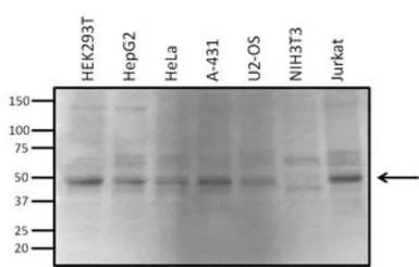 Anti-VRK1 antibody [1F6] used in Western Blot (WB). GTX79470