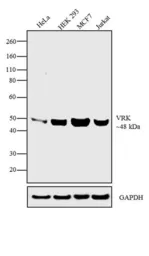 Anti-VRK1 antibody [1F6] used in Western Blot (WB). GTX79470
