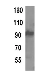 Anti-TPX2 antibody [18D5-1] used in Western Blot (WB). GTX79474