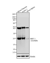 Anti-Mist1 antibody [6E8/A12/C11P1] used in Western Blot (WB). GTX79479