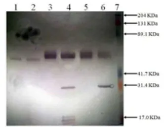 Anti-Prorenin/Renin antibody used in Western Blot (WB). GTX79677