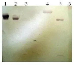 Anti-Plasminogen antibody [11B5-B2] used in Western Blot (WB). GTX79694