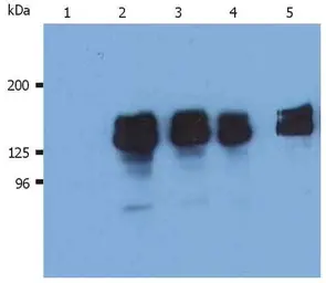 Anti-SHIP1 antibody [SHIP-02] used in Western Blot (WB). GTX79893