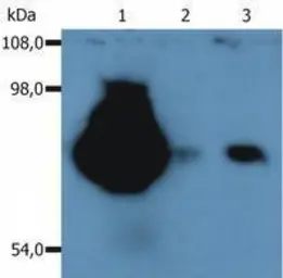 Anti-CD44 antibody [MEM-263] (PE) used in Western Blot (WB). GTX79959