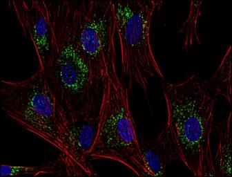 Anti-CD63 antibody [MEM-259] (PerCP) used in Immunocytochemistry/ Immunofluorescence (ICC/IF). GTX79964
