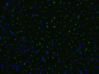 Anti-CD105 antibody [MEM-229] (FITC) used in Immunocytochemistry/ Immunofluorescence (ICC/IF). GTX79974