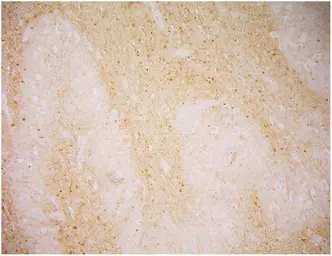 Anti-PSMA antibody [GCP-04] used in IHC (Paraffin sections) (IHC-P). GTX80151