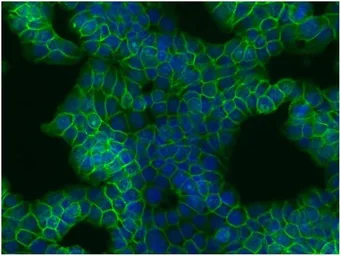 Anti-beta Catenin antibody [EM-22] used in Immunocytochemistry/ Immunofluorescence (ICC/IF). GTX80159